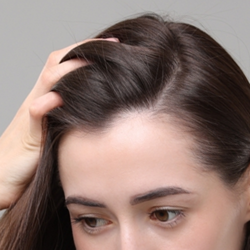 Female hair transplant in delhi
