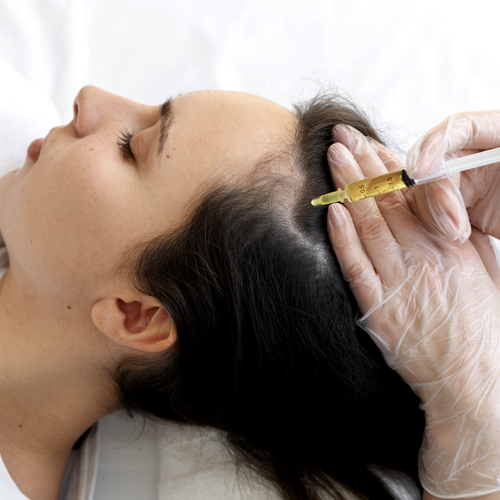 GFC treatment for hair loss delhi