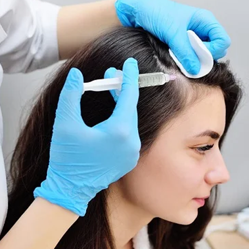 PRP therapy for hair loss delhi