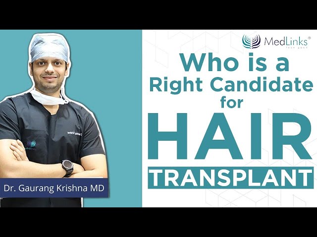Shockloss after hair transplant surgery in delhi