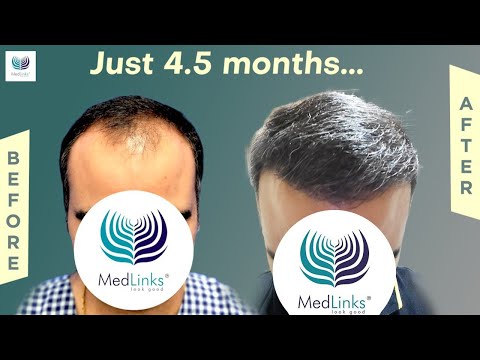 Medlinks