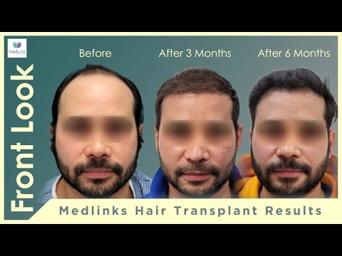Medlinks