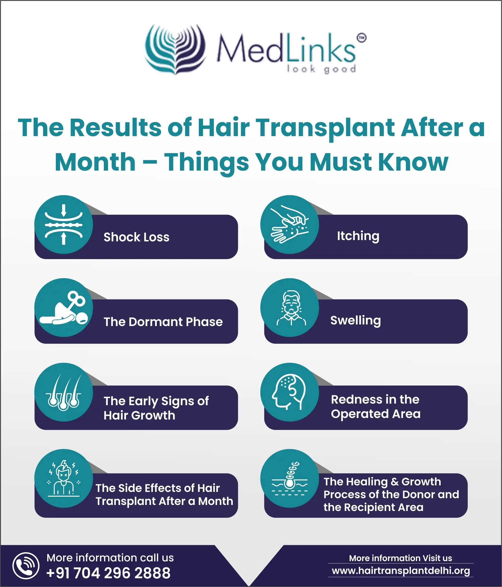 hair-transplant-after-1-month-photos-results-side-effects
