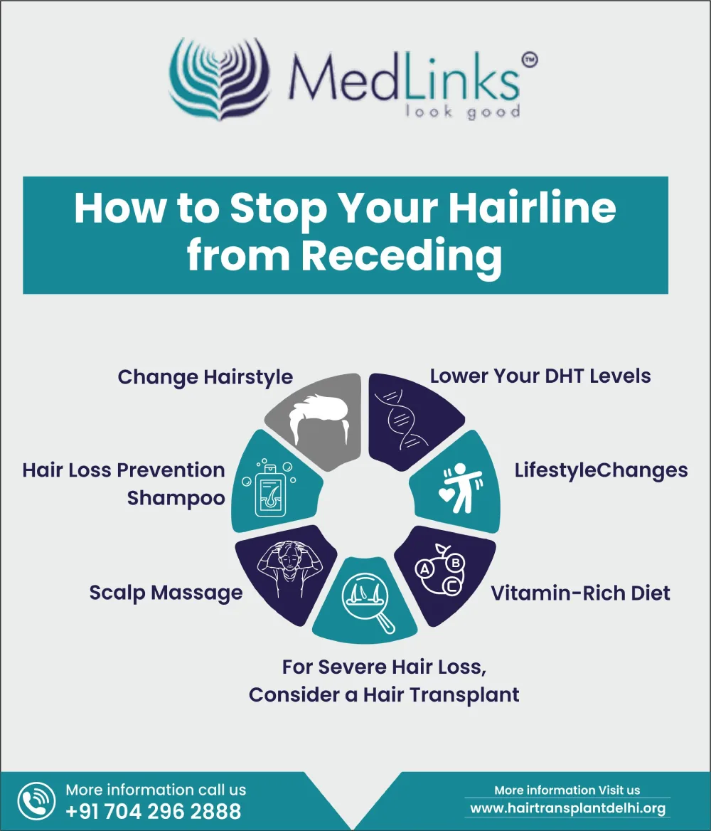 how-to-stop-receding-hairline
