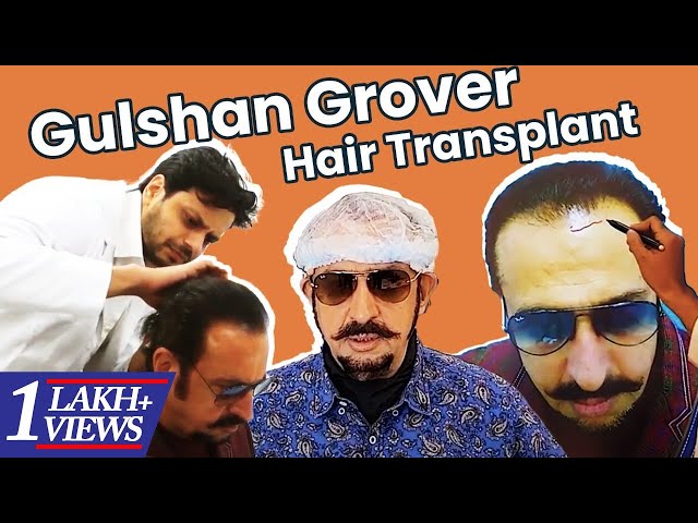 Best hair transplant in india