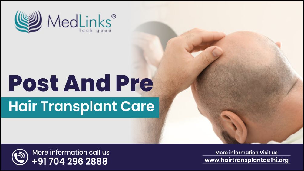 Before and After Hair Transplant- Step by Step Guide