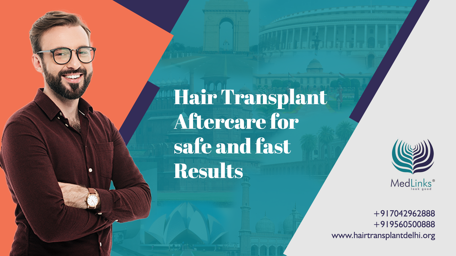 How To Take Care of Hair After a Hair Transplant