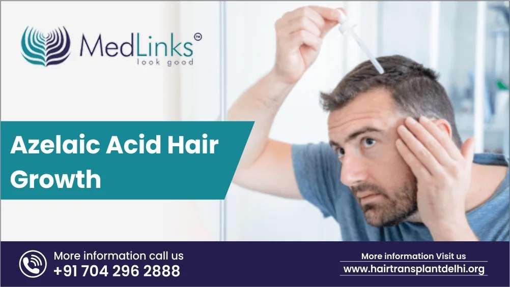What Are The Benefits Of Azelaic Acid For Hair Growth