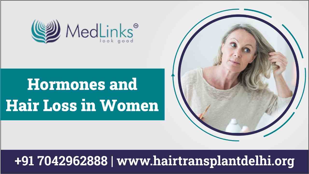Hair Loss in Women: Connection Between Hormones and Hair Loss