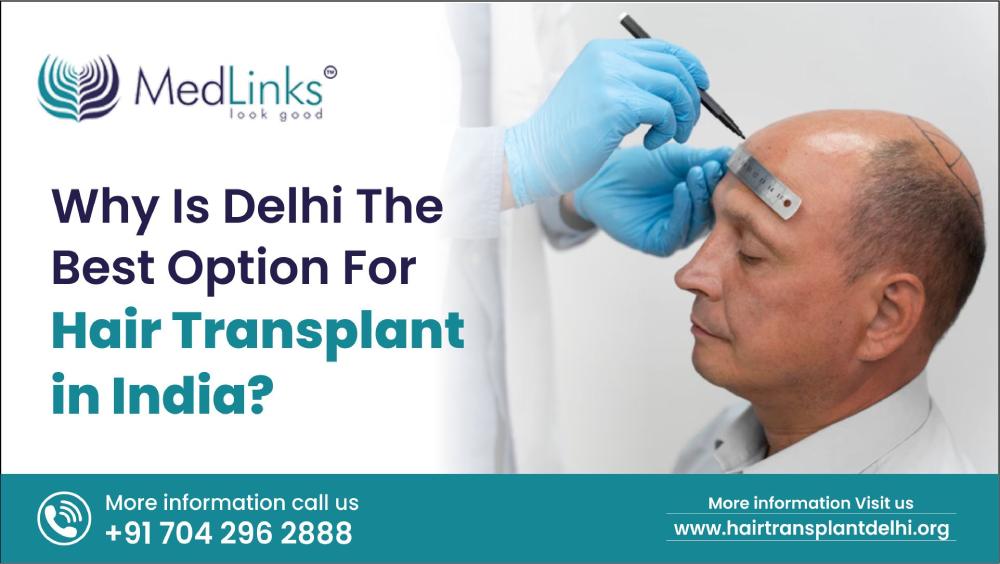 Why Delhi Is The Best Option For Hair Transplant In India?