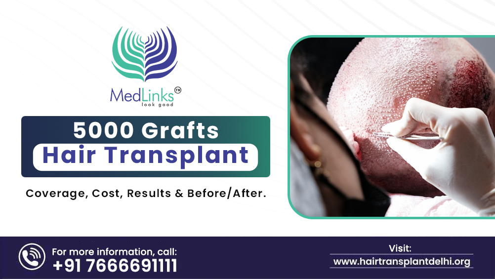 hair transplant in india