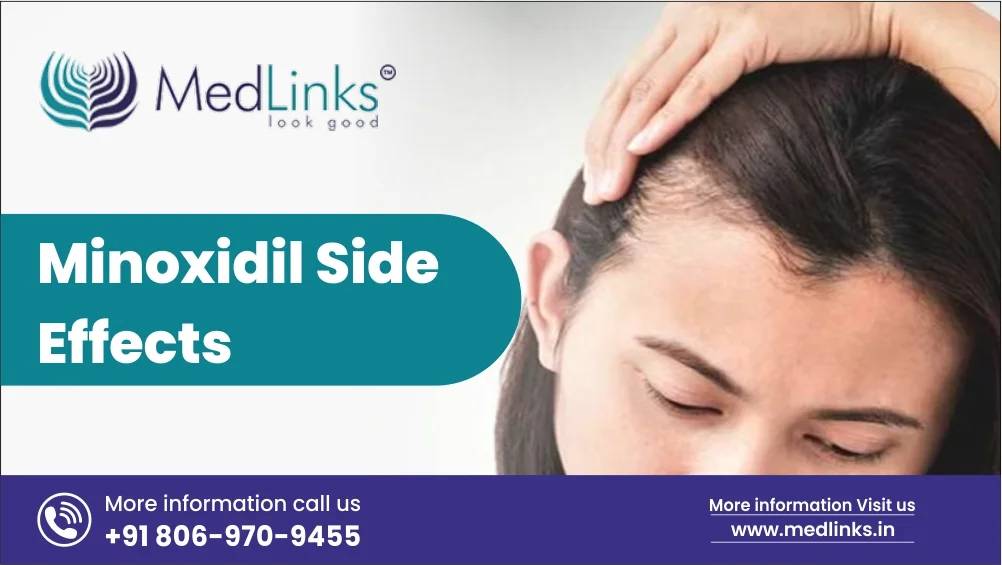 Minoxidil Side Effects