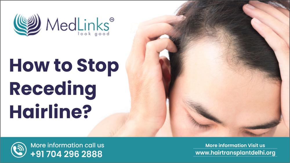 How to Stop Receding Hairline?
