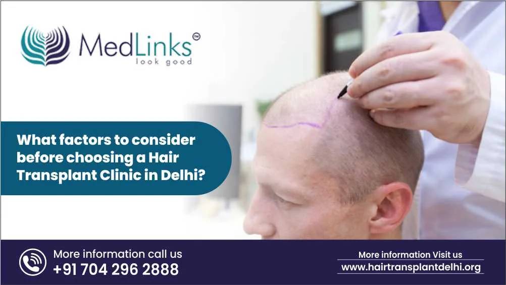 What Factors to Consider Before Choosing a Hair Transplant Clinic in Delhi?