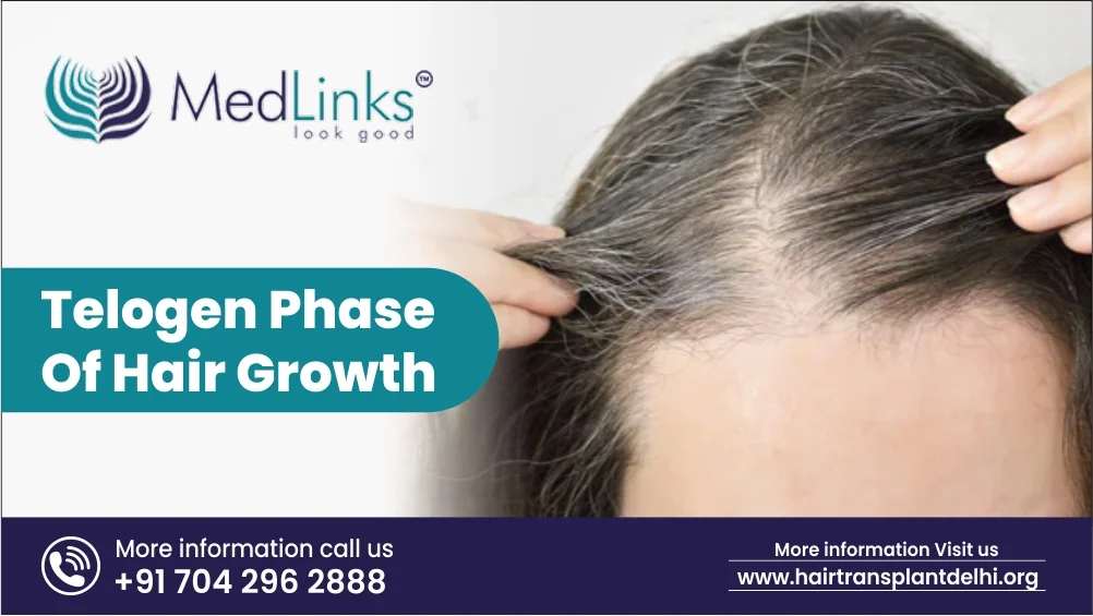 Telogen Phase of Hair Growth