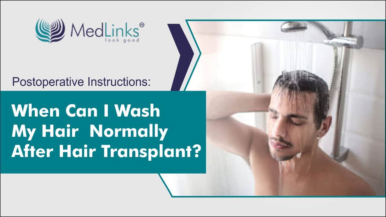 When can I wash my hair normally after a hair transplant?