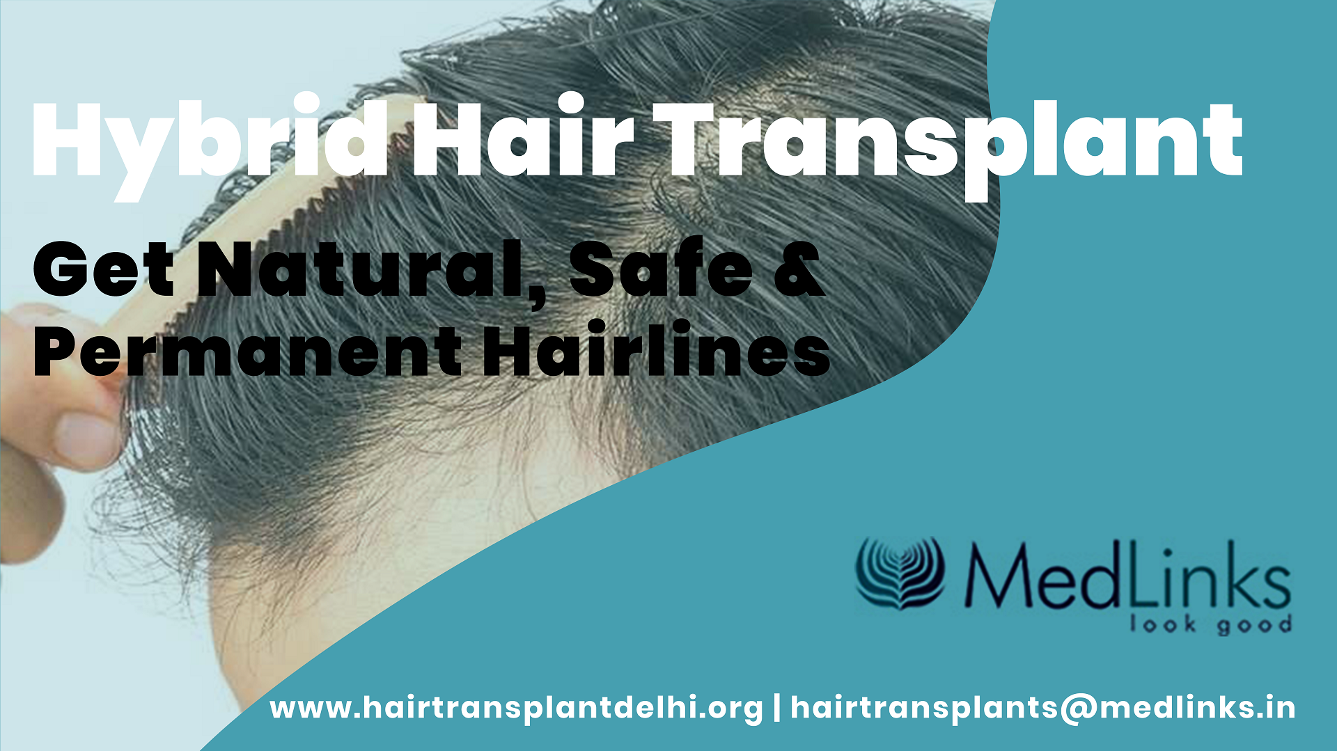 Best Bio FUE Hair Transplant in Chandigarh  Alayaa Clinic