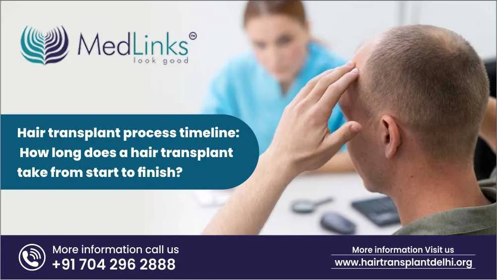 Hair transplant process timeline: How long does a hair transplant take from start to finish?