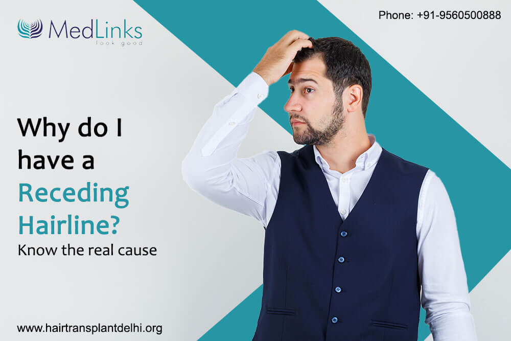 Why Do I Have a Receding Hairline?