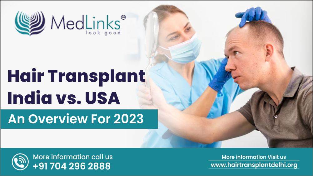 Hair Transplant India vs. USA – An Overview For 2023