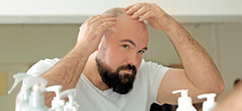 Factors to Consider before Getting a Hair Transplant: Time and Age