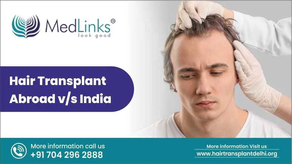Hair Transplant Abroad v/s India