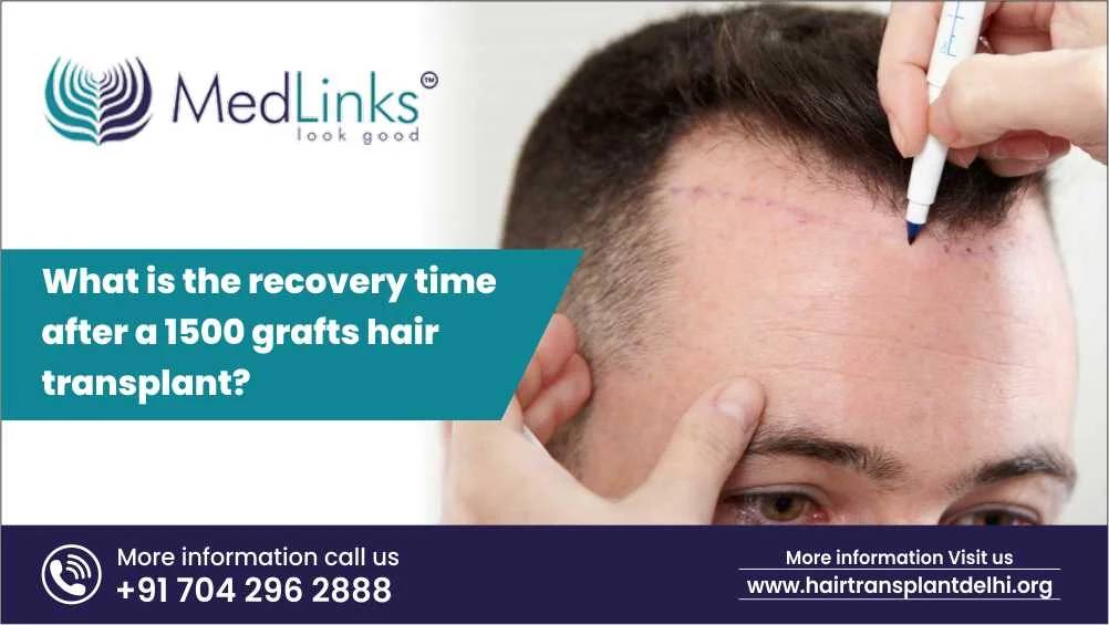 What Is The Recovery Time After A 1500 Grafts Hair Transplant | Medlinks HT