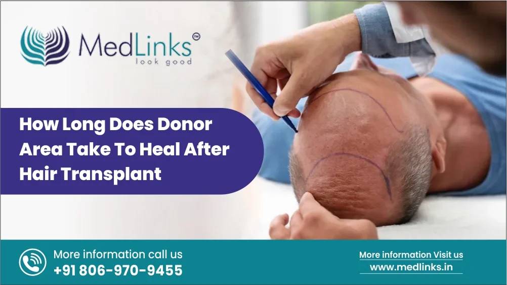 How Long Does Donor Area Take to Heal After Hair Transplant?