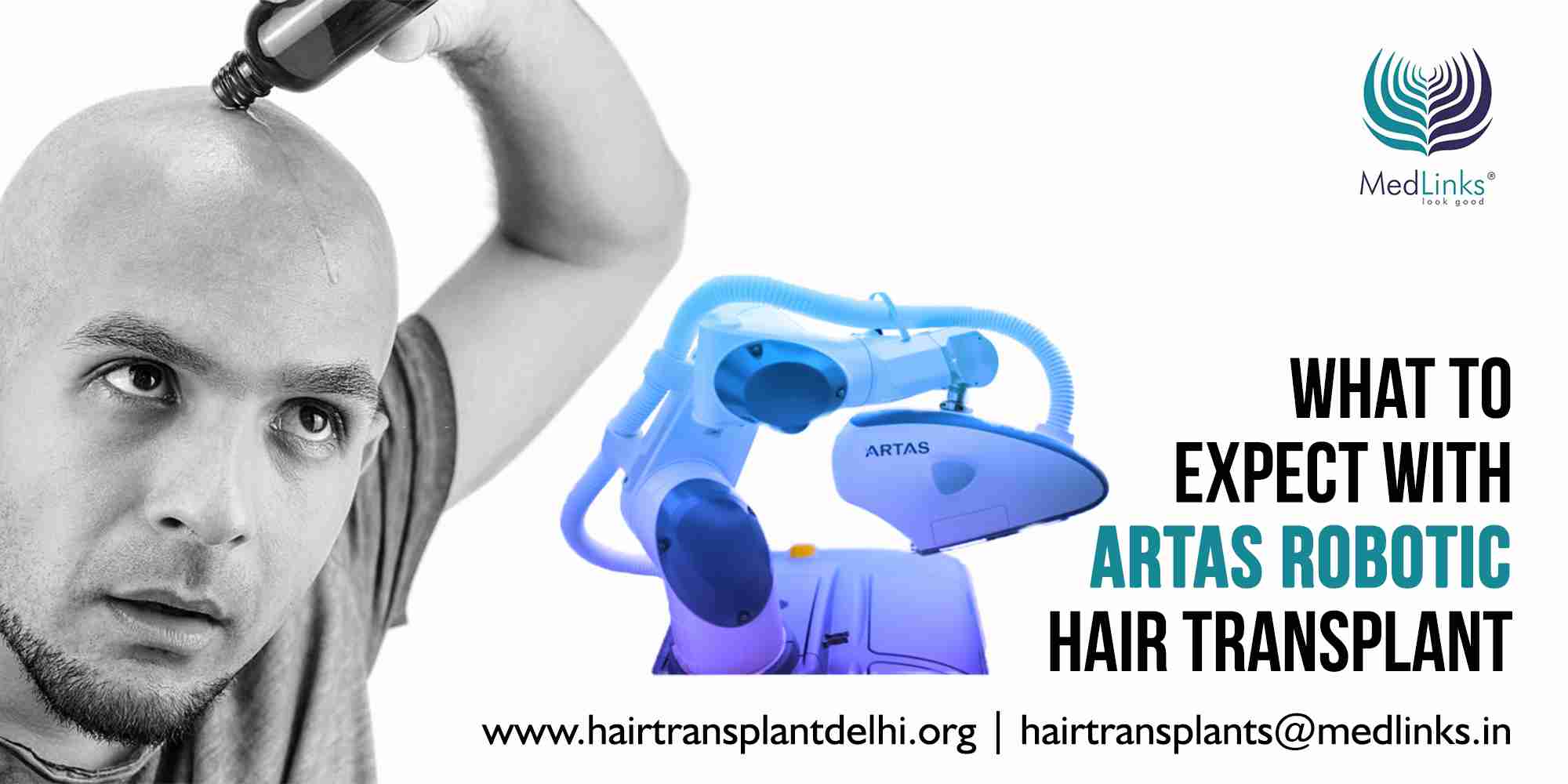 Artas Robotic Hair Transplant In Delhi Ncr | Medlink