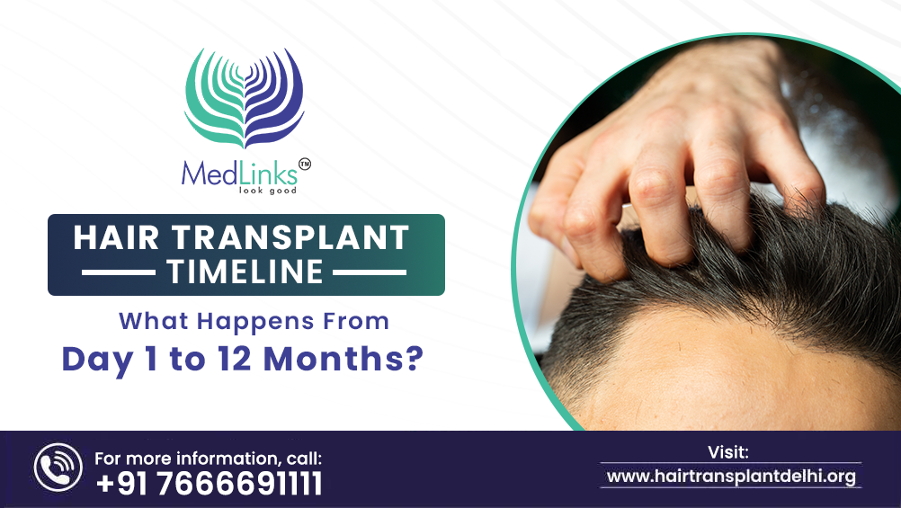 hair transplant in india
