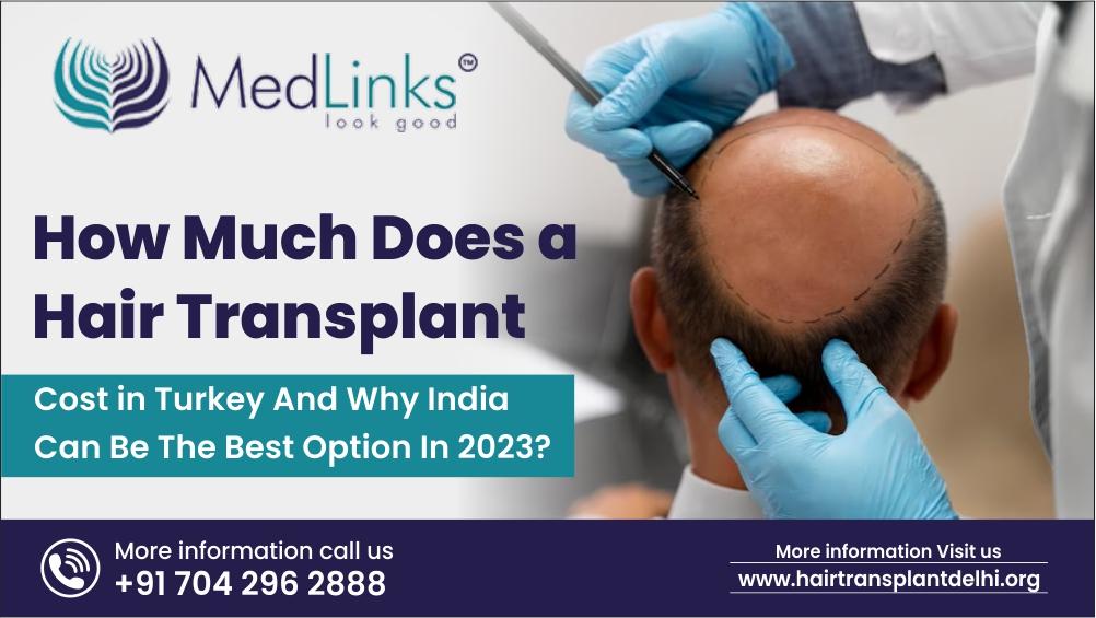 How Much Does a Hair Transplant Cost in Turkey And Why India Can Be The Best Option In 2023?