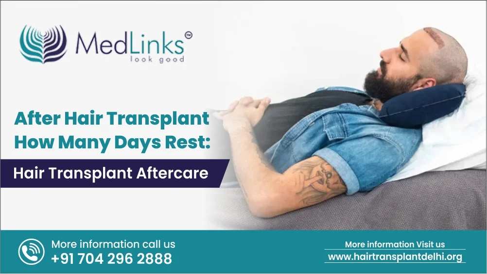 After Hair Transplant How Many Days Rest is required : Hair Transplant Aftercare