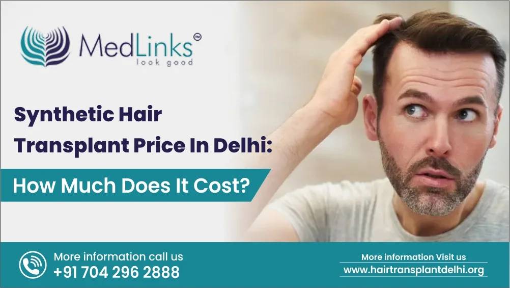 Synthetic Hair Transplant Price In Delhi: How Much Does It Cost?
