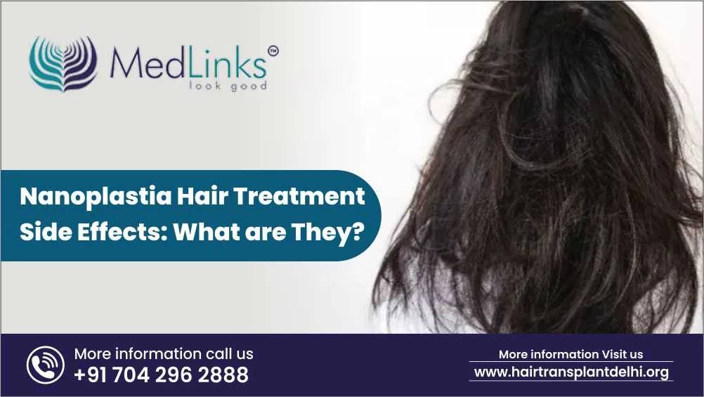 Nanoplastia Treatment Side Effects: What Are They?