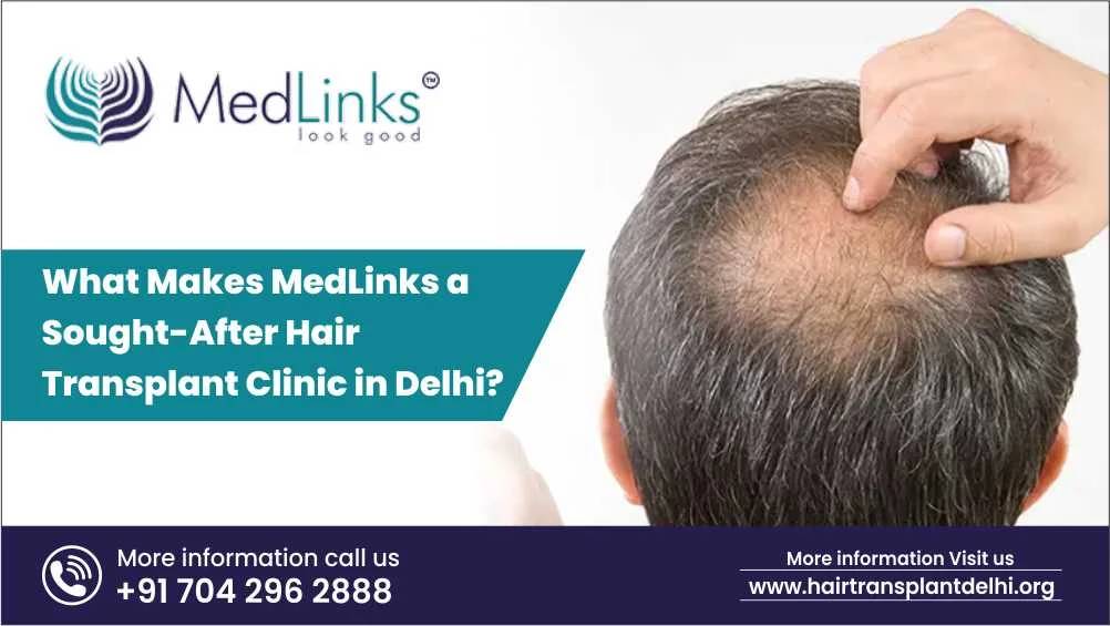 What Makes MedLinks a Sought-After Hair Transplant Clinic in Delhi?