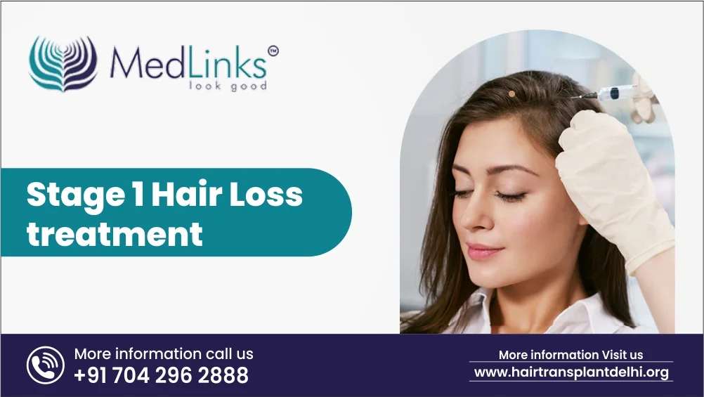 Stage 1 Hair Loss Treatment