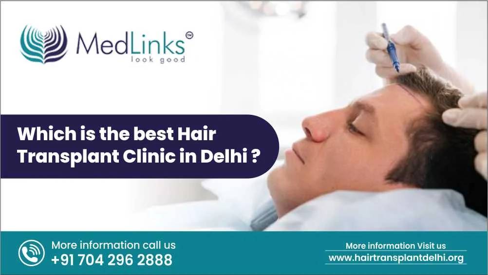 Which Is the Best Hair Transplant Clinic in Delhi?