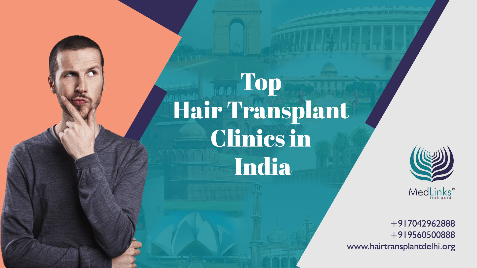 Top Hair Transplant Clinics in India - Medlinks | Medlinks