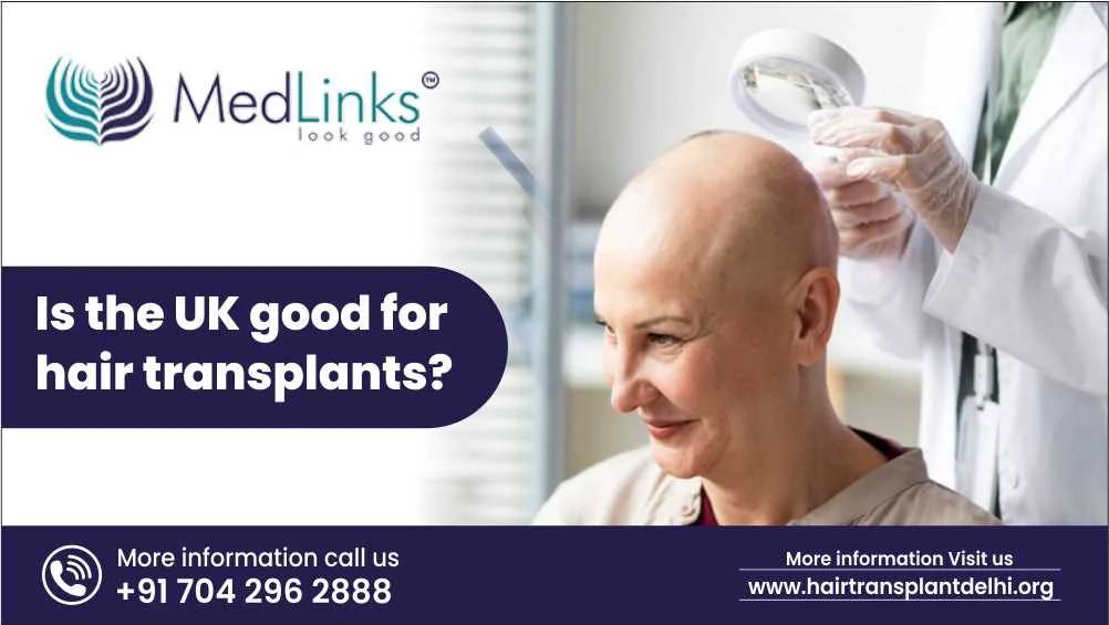 Is the UK Good for Hair Transplants?