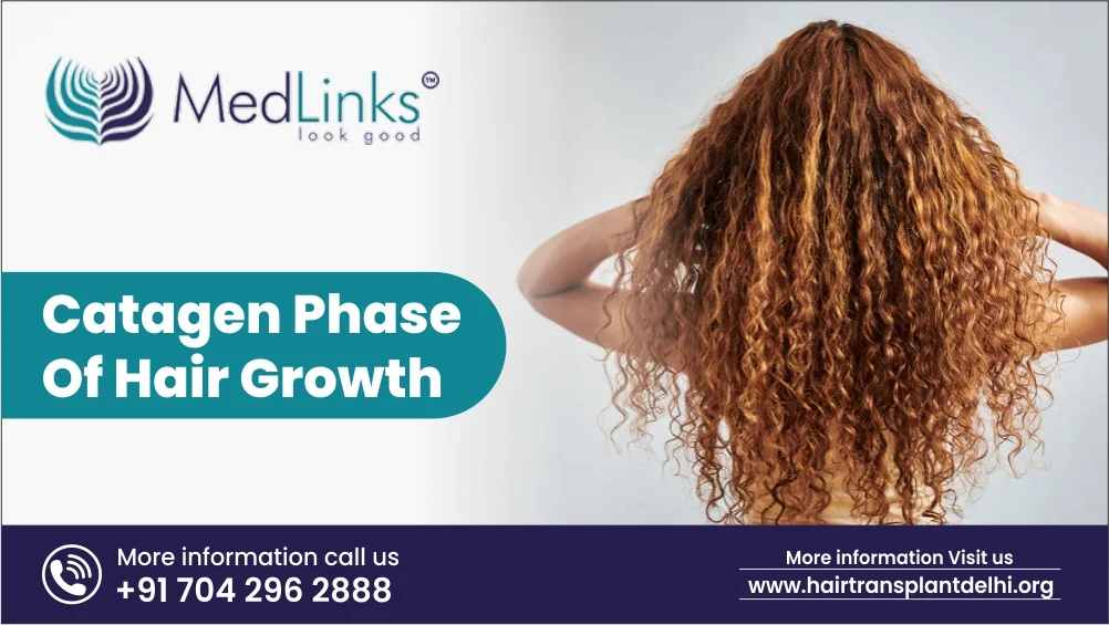 Catagen Phase of Hair Growth