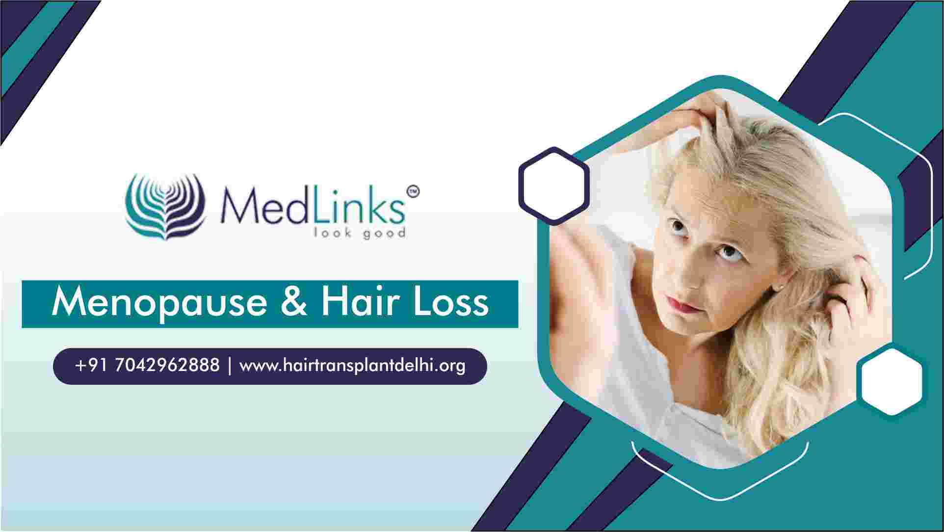 Hair Loss During Menopause 
