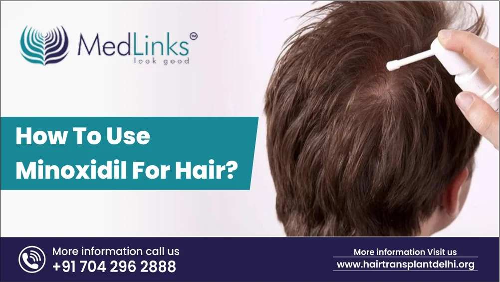 hair transplant in india