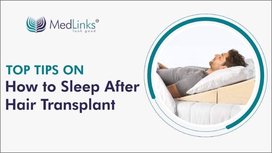 Top Tips on How to Sleep After Hair Transplant?