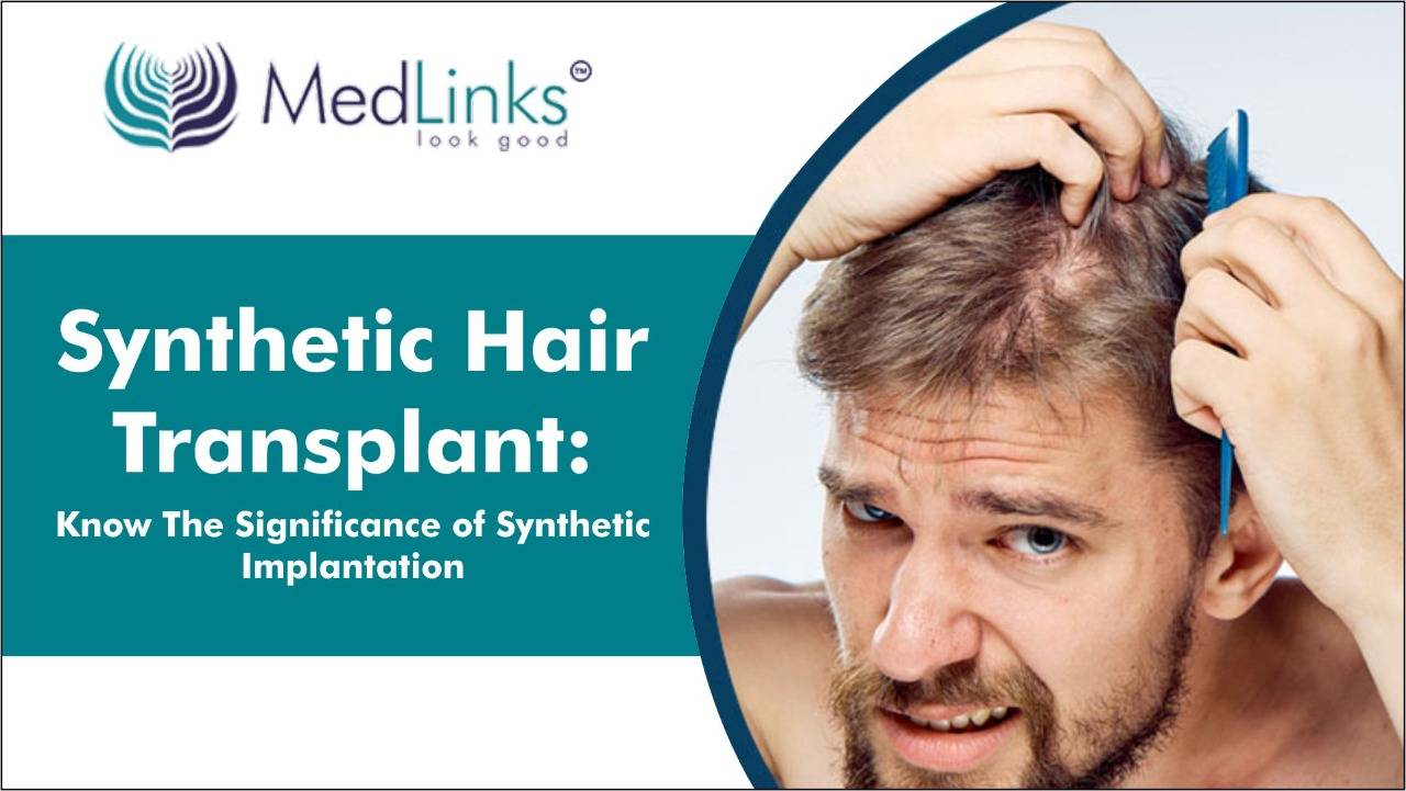 Synthetic Hair Transplant: Significance of Synthetic Implantation | Medlinks