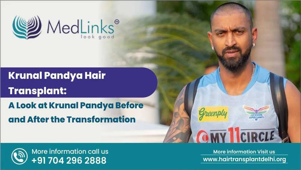 hair transplant in india