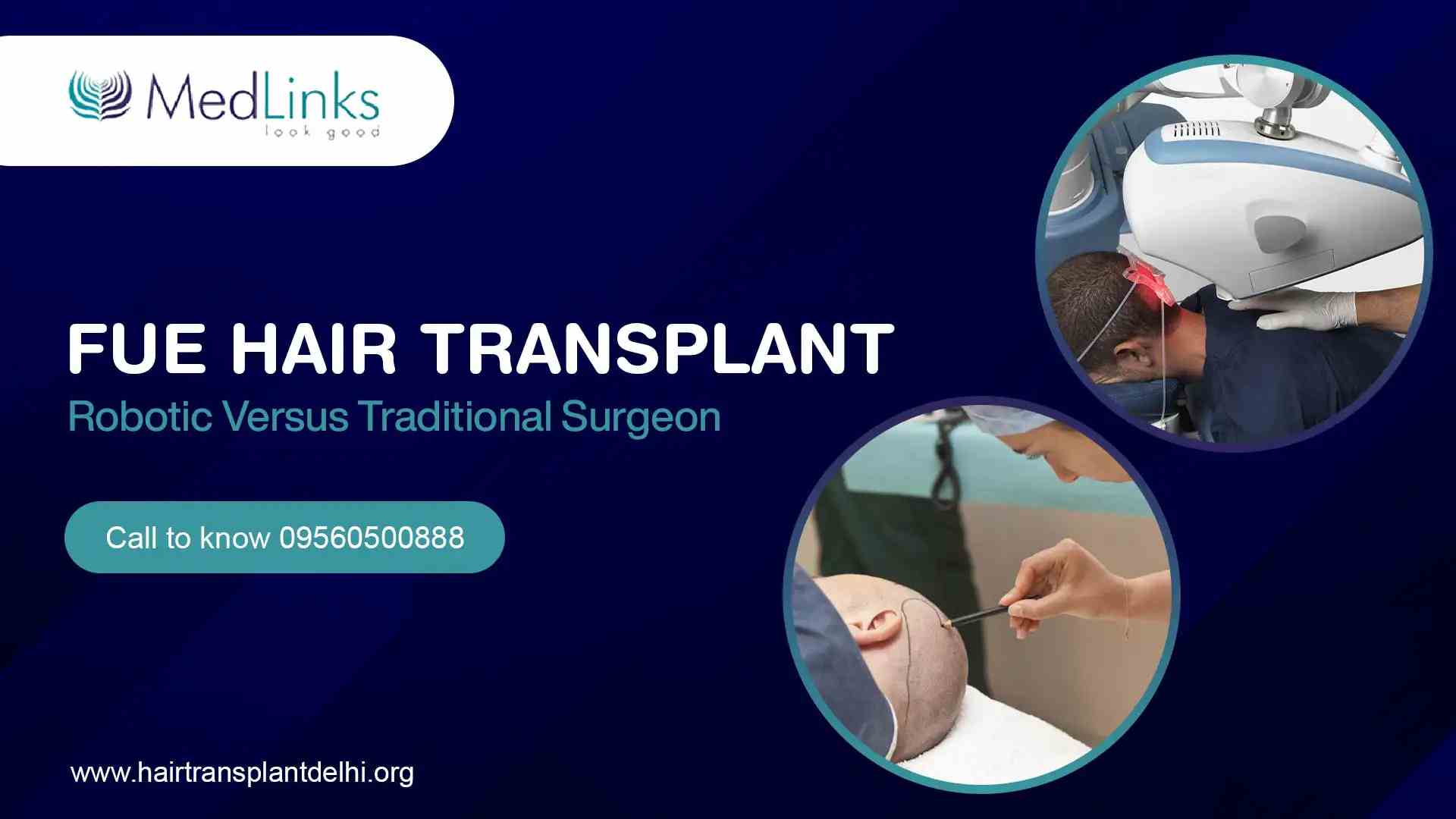 FUE Hair Transplant – Robotic vs. Traditional Surgery