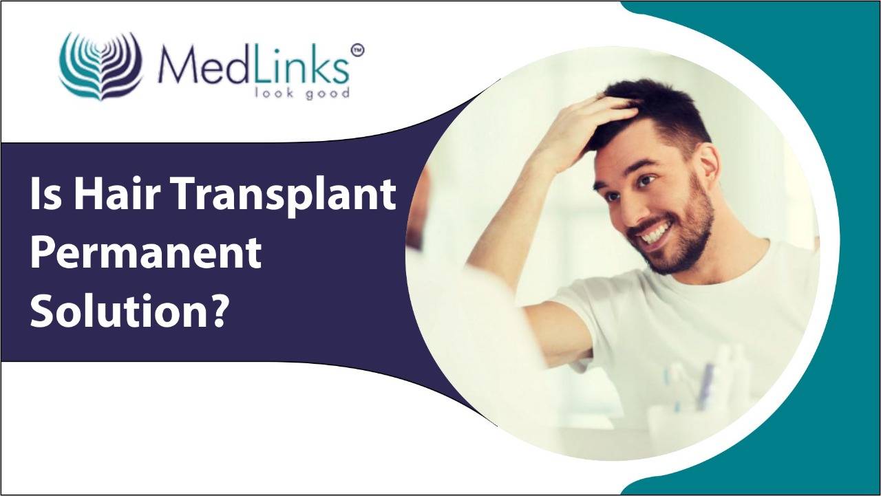 Is Hair Transplant Permanent? How Long Do Hair Transplants Last?