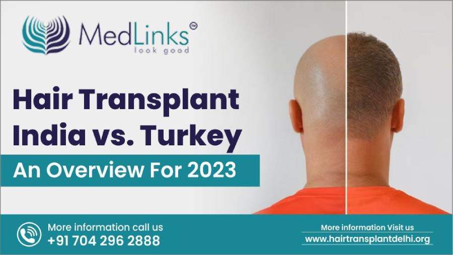 Hair Transplant India vs. Turkey – An Overview For 2023