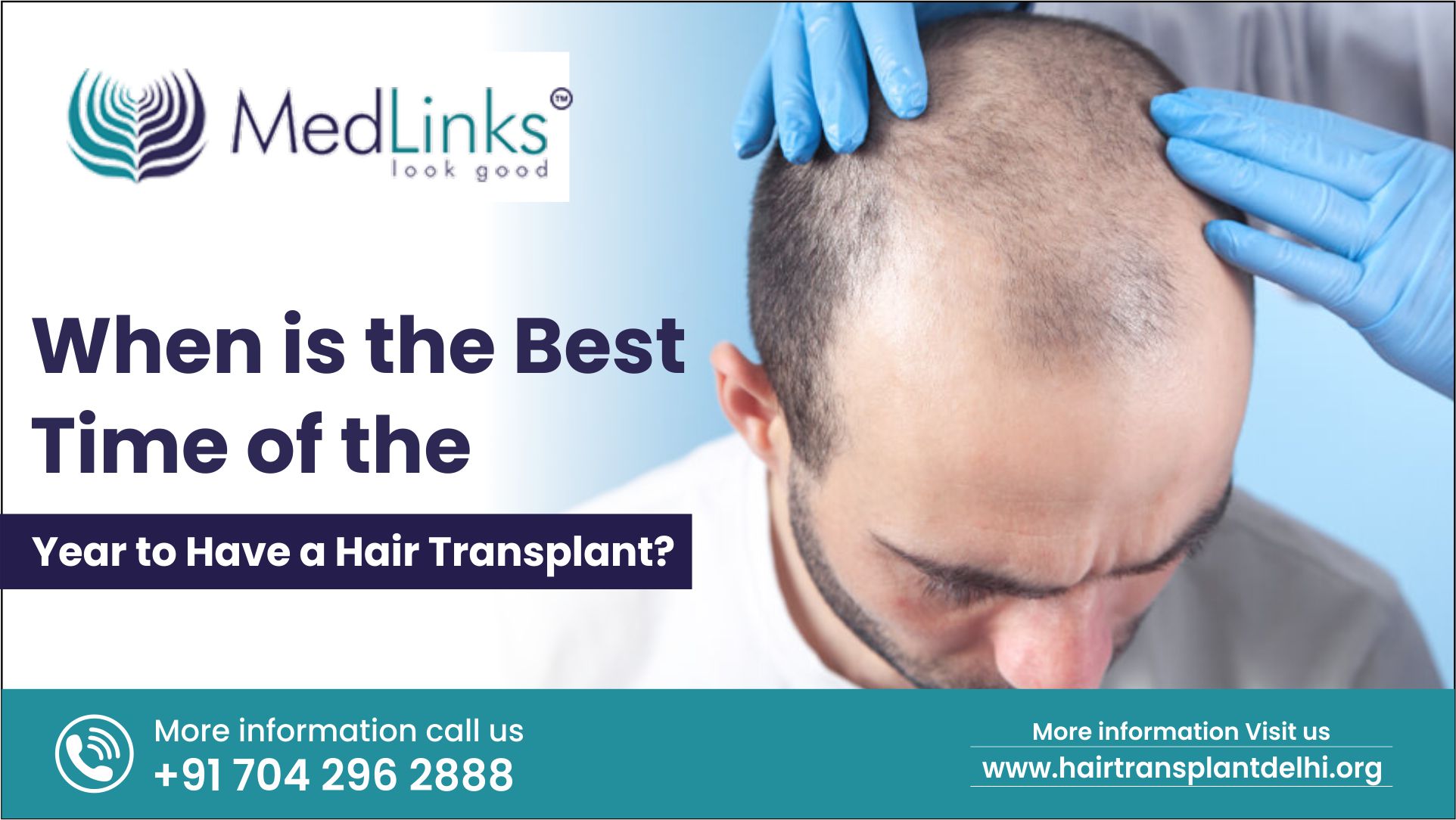 When Is The Best Time Of The Year To Have a Hair Transplant?