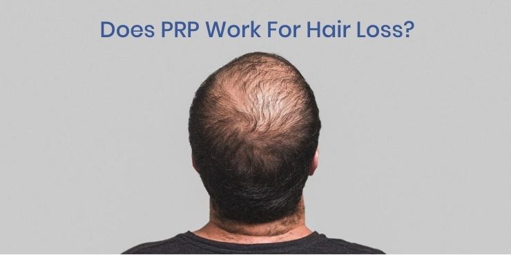 Does Hair Regrowth Treatment For Hair Loss Really Work? | Know The Truth
